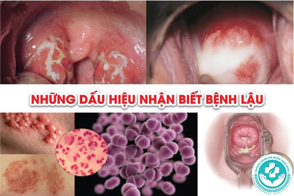 Khám và chẩn đoán nguyên nhân gây khí hư bất thường ở 8Day - trang web uy tín đăng ký & đăng nhập dễ dàng