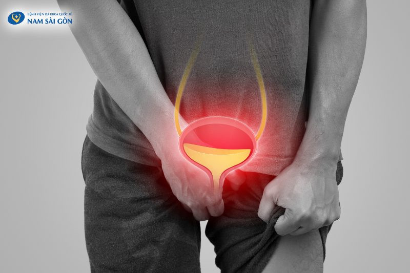 Bàng quang khi bị vi khuẩn xâm nhập gây viêm sưng