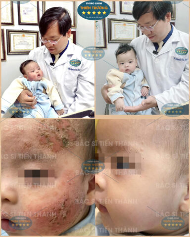 Chuyên gia da liễu Nguyễn Tiến Thành thăm khám da cho bệnh nhi tại 8Day - trang web uy tín đăng ký & đăng nhập dễ dàng.